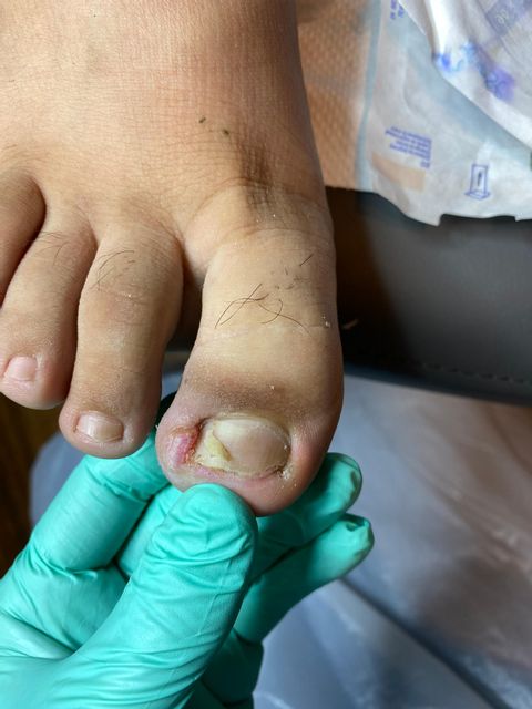 imagine galerie Estetic PediCare 1