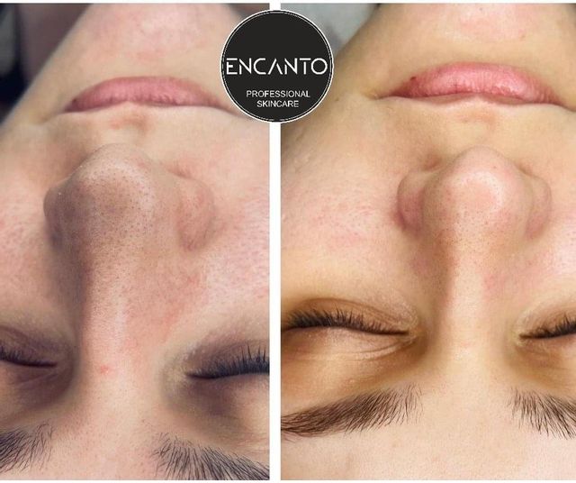 imagine galerie ENCANTO SkinCare by Simona Banaru 5