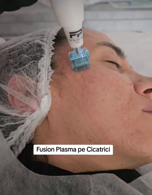 imagine galerie Alina Fusion Plasma 3