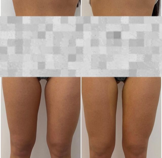 responsive image 33