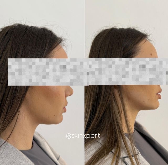 responsive image 35