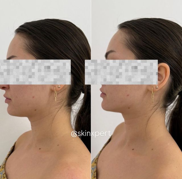 responsive image 36