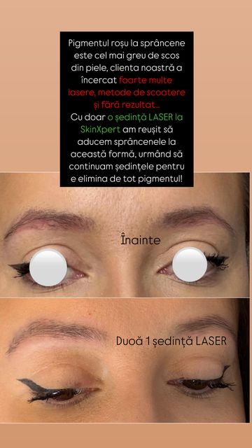 responsive image 38