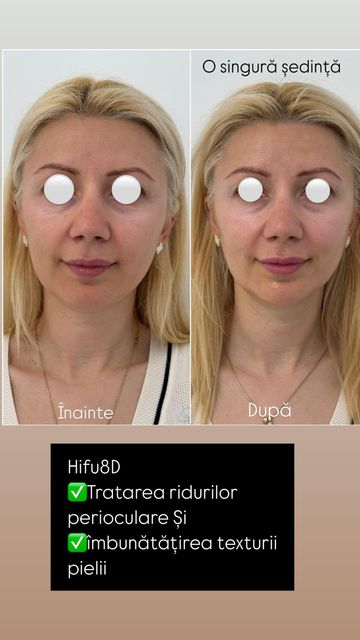 responsive image 45