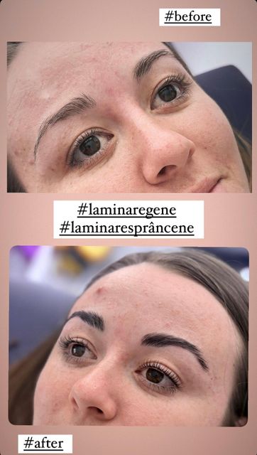 imagine galerie Brow Lash by Alice Cojocaru 4
