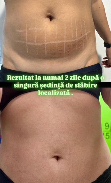 responsive image 0