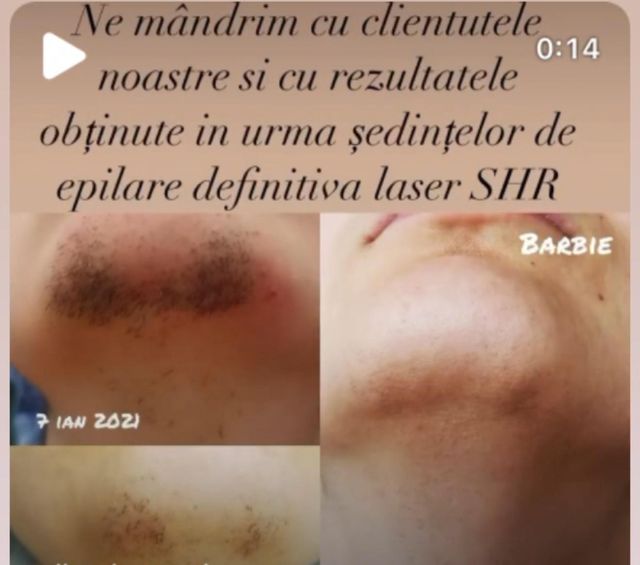responsive image 32