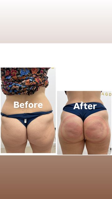 responsive image 100