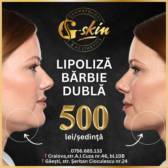 responsive image 36