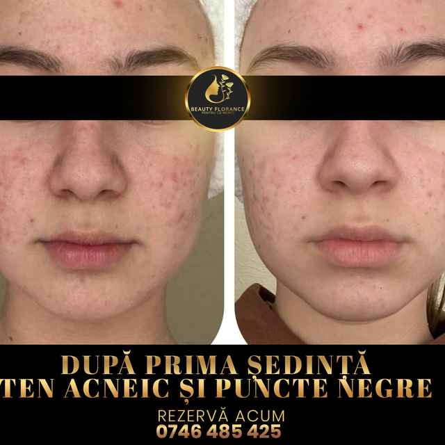 responsive image 30