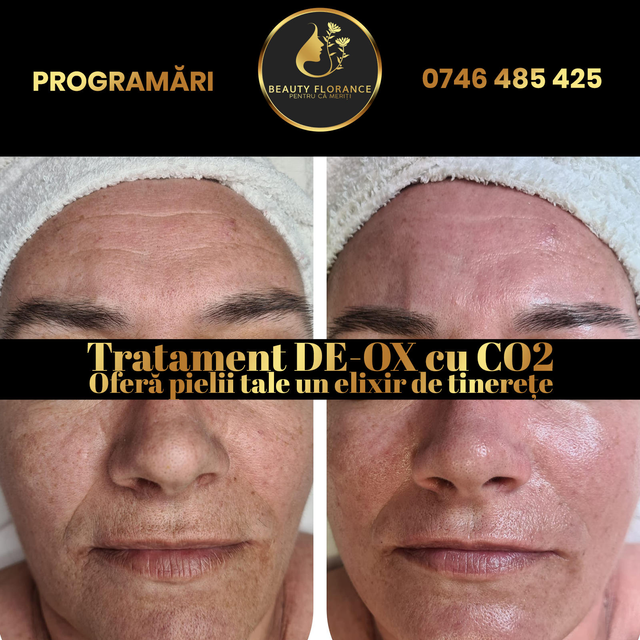 responsive image 32