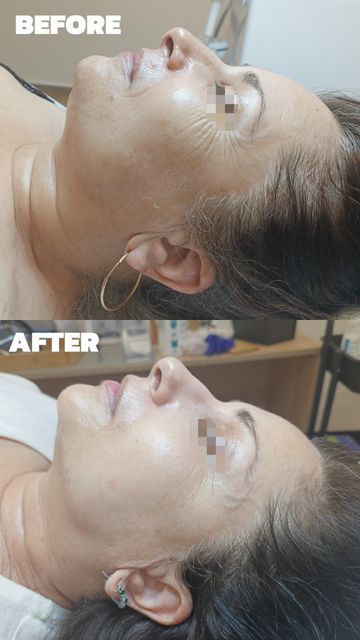 imagine galerie PhysioBeauty 3