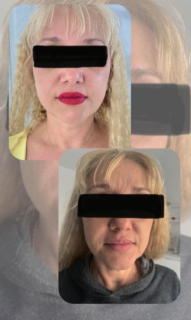imagine galerie My Healthy Skin Clinic 4