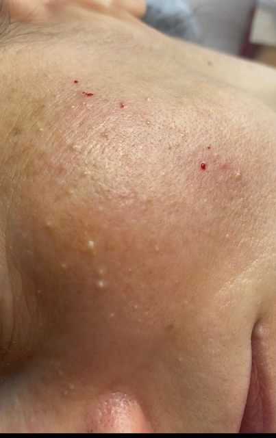 imagine galerie CosMedMIcosmeticamedicala Mihaela Epure 4
