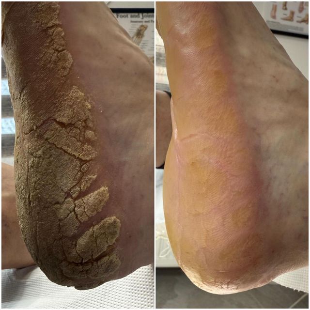 imagine galerie MedicalPedi_Cornelia.Șandor 5