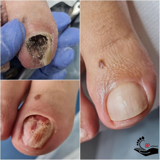 imagine galerie MedicalPedi_Cornelia.Șandor 6