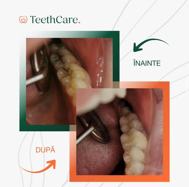 imagine galerie Teeth Care  2