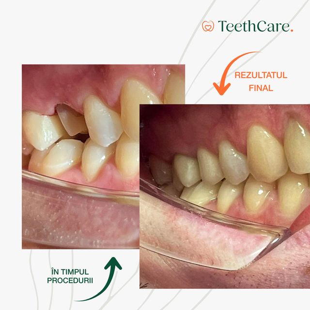 imagine galerie Teeth Care  3
