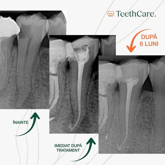 imagine galerie Teeth Care  4