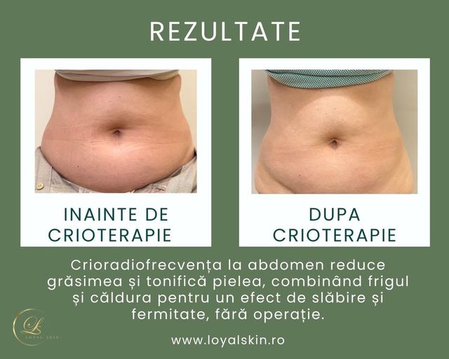 imagine galerie Loyal Skin 4