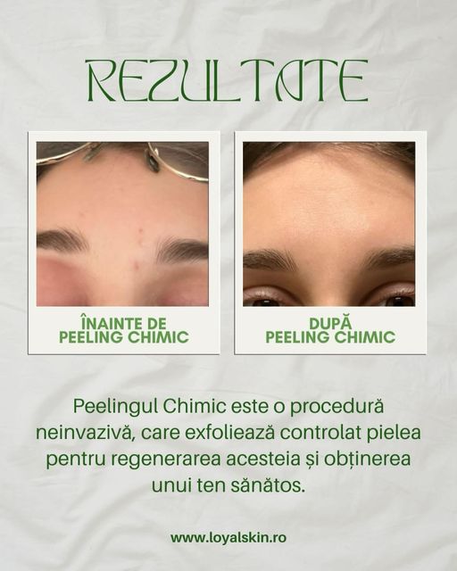 imagine galerie Loyal Skin 6