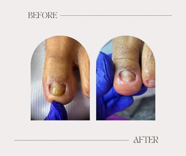 imagine galerie Ioana Mocanu Nailtehnician/Tehnician Pedichiura medicală 3