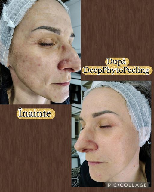 imagine galerie Paola 💎 Cosmetica & Micropigmentare 1