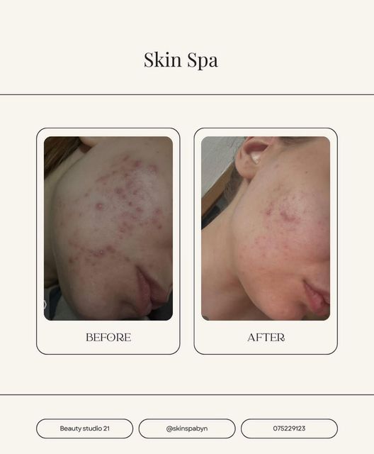 imagine galerie Skin Spa 5