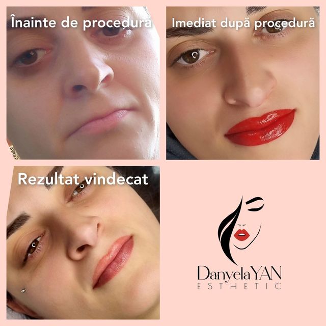 responsive image 20