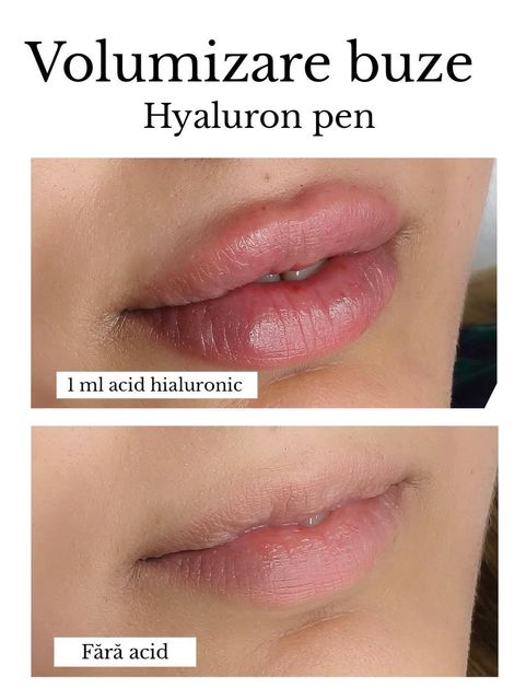 responsive image 45