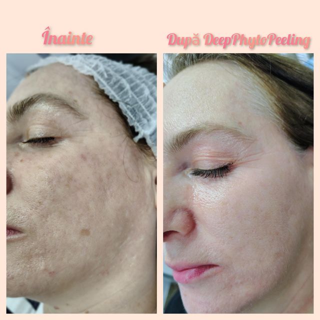 imagine galerie Paola 💎 Cosmetica & Micropigmentare 2