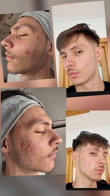 imagine galerie Timeless Skin 5