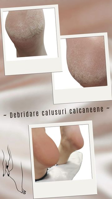 responsive image 35