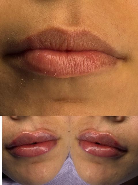 responsive image 0