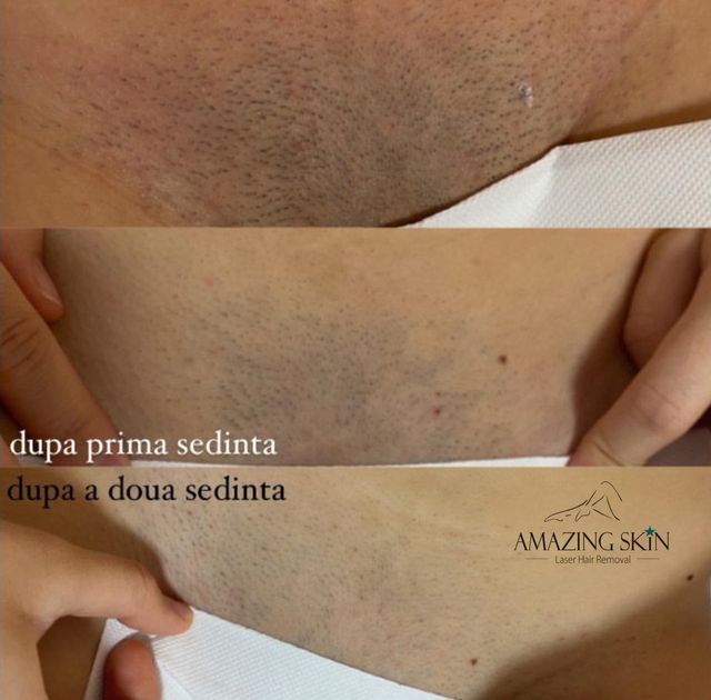 responsive image 11