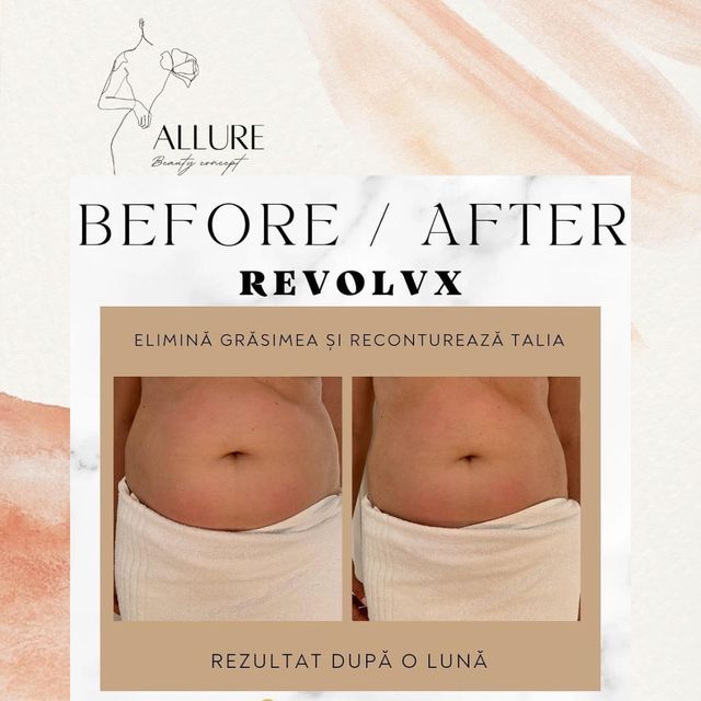 imagine galerie Allure Beauty Concept 6