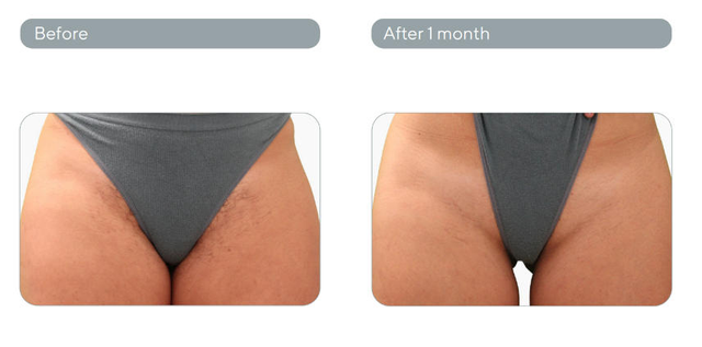 responsive image 11