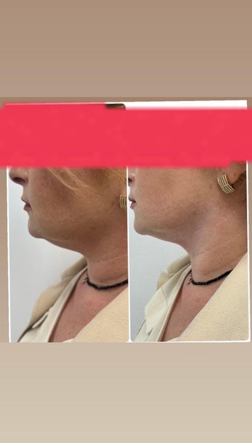 responsive image 111