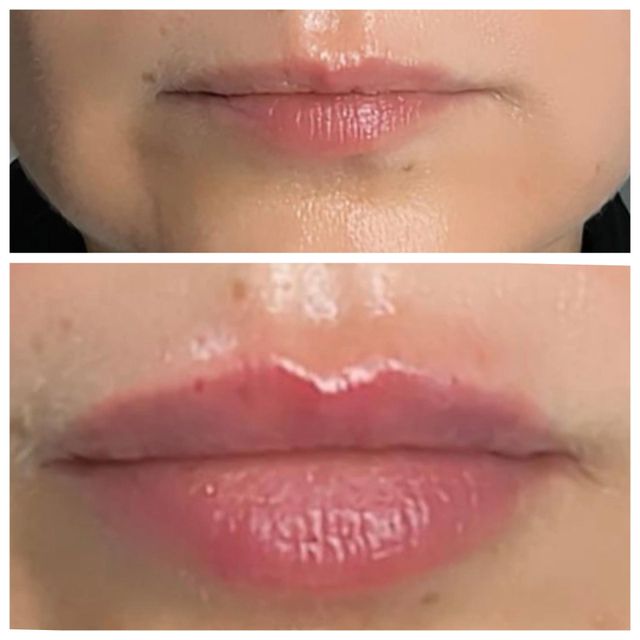 responsive image 46