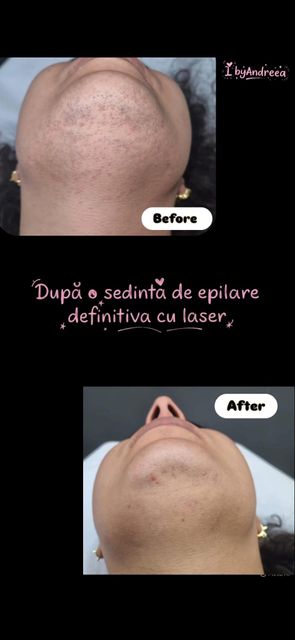 responsive image 30