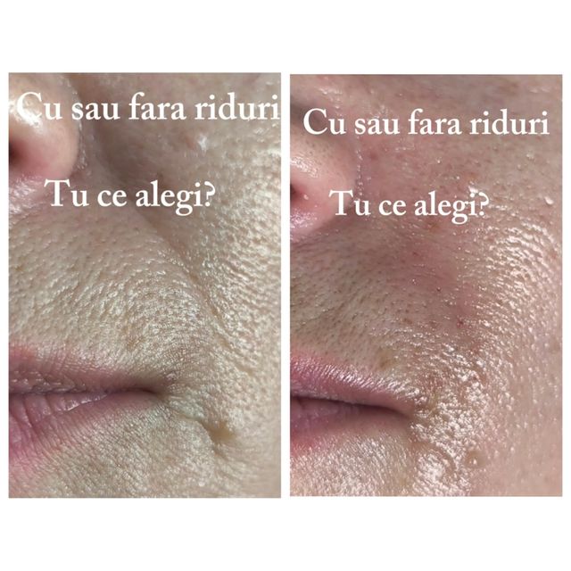 responsive image 52