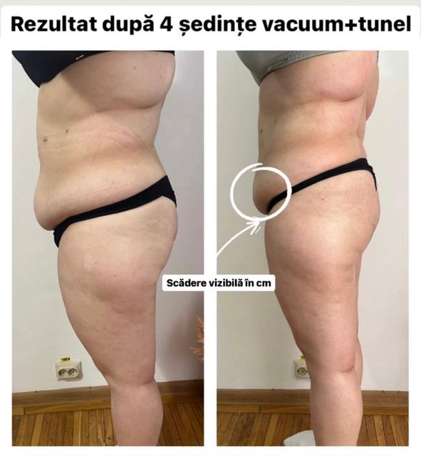 responsive image 25