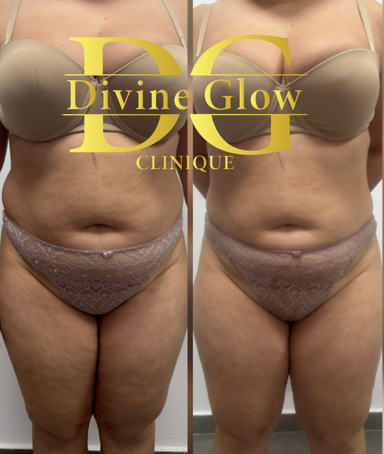 imagine galerie Divine Glow Clinique 6