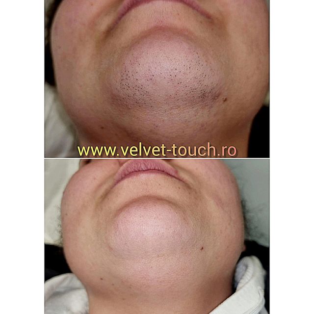 responsive image 28