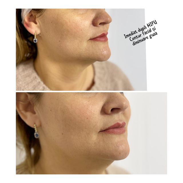 responsive image 39