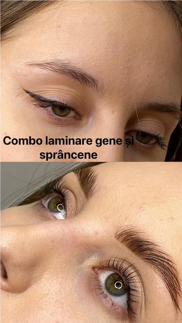 responsive image 35