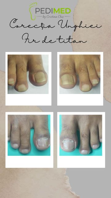 responsive image 94