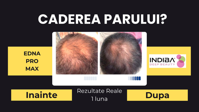 responsive image 18