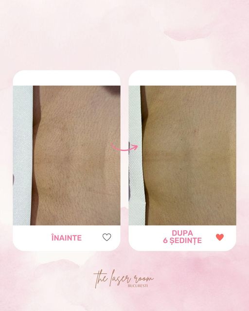 responsive image 0
