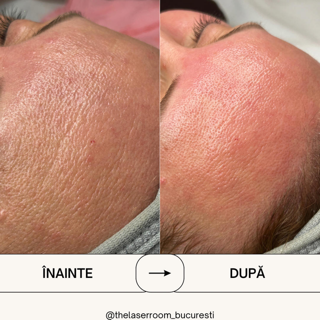 responsive image 30